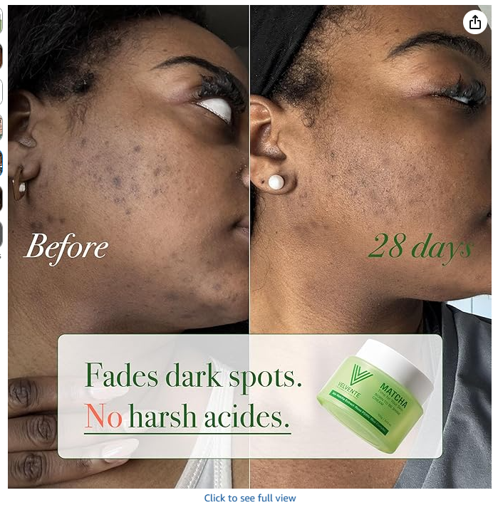 VELVENTE Matcha Cream - Fades dark spots in 28 days, no harsh acids